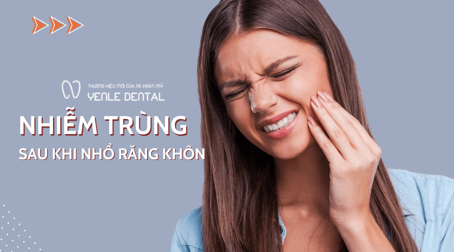 nhiễm trùng sau khi nhổ răng khôn